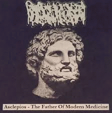 Hydrocephalus : Asclepios - The Father of Modern Medicine